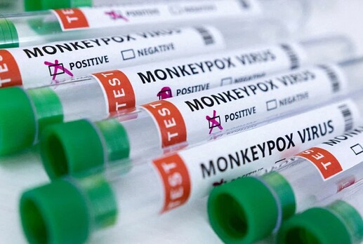 Monkeypox test tubes